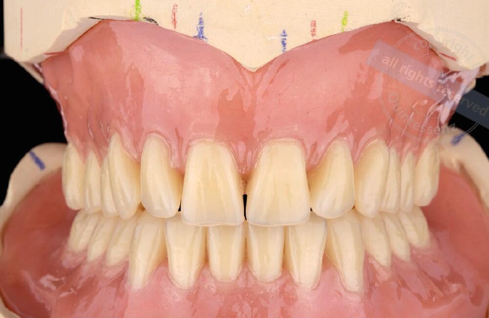 Veröffentlichung von Eckhardt Dentaltechnik