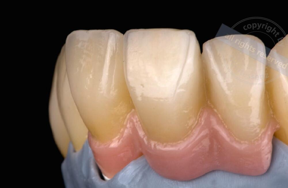 Veröffentlichung von Eckhardt Dentaltechnik