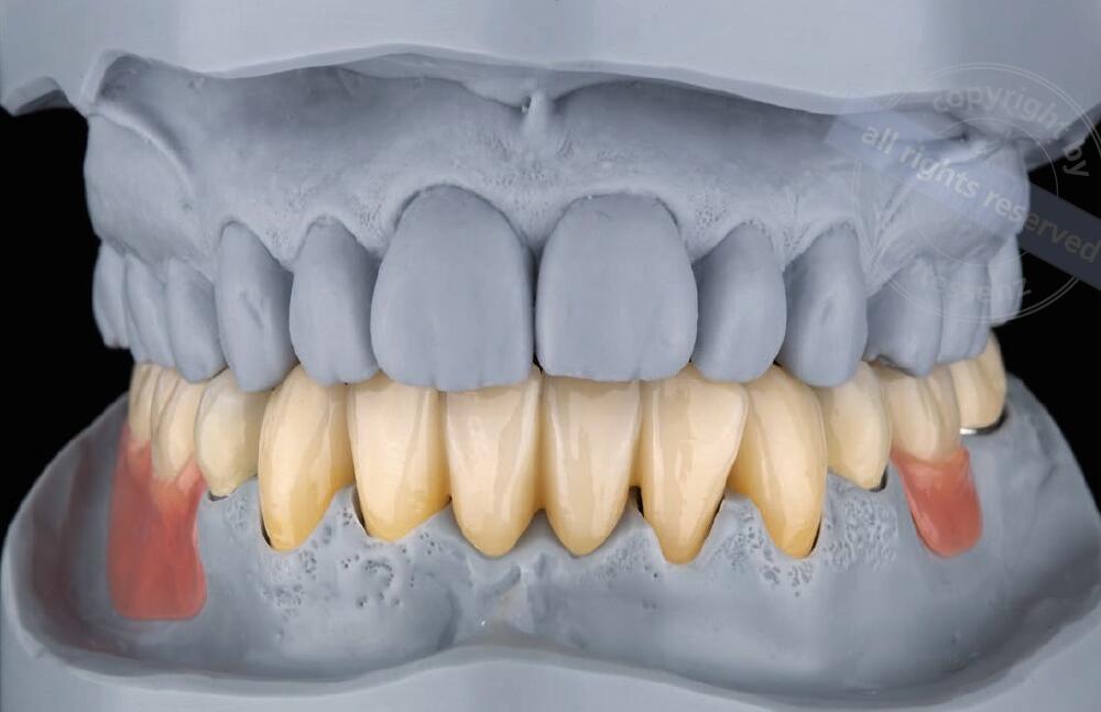 Veröffentlichung von Eckhardt Dentaltechnik